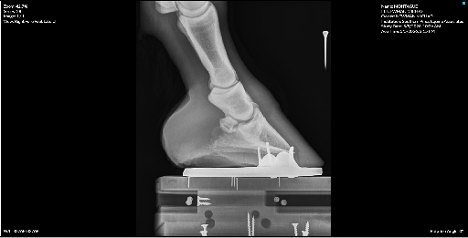 Right Forefoot Lateral